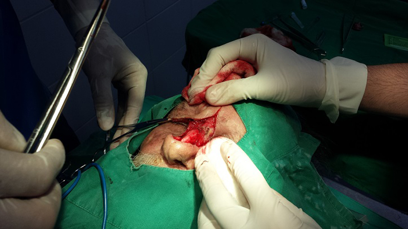 Cirugía Plástica y Caumatología