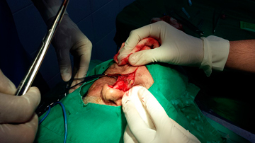 Cirugía Plástica y Caumatología