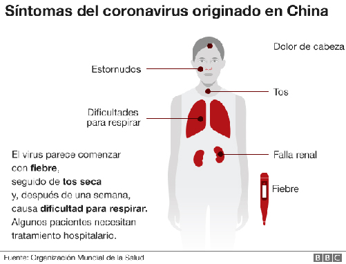 Infografía