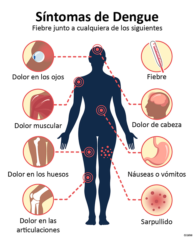 sintomas dengue