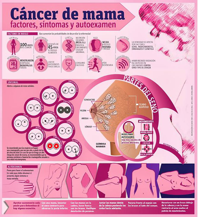  infografia